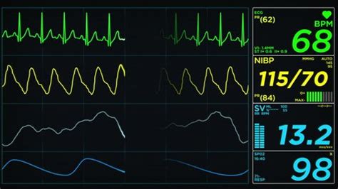 Medical Monitor Screen On Normal Heart Stock Footage Video (100% ...