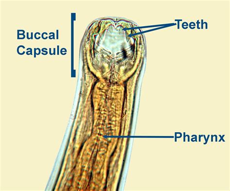 Ancylostoma Duodenale Morphology Labeled