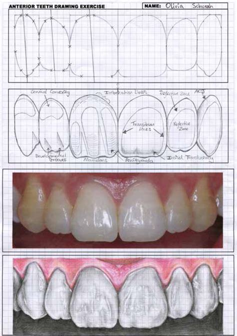 Dental Update - Tooth anatomy: a practical guide part 2: drawing ...