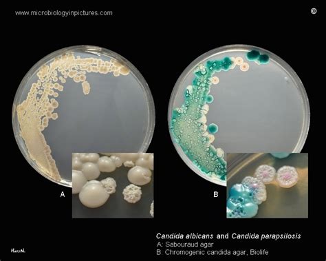 Colony morphology and appearance of Candida albicans, C.parapsilosis on ...