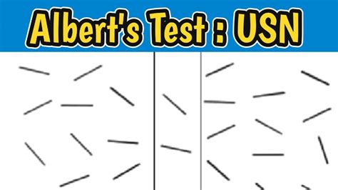 Albert's Test | Identifying Unilateral Spatial Neglect Using Albert's Test | USN | - YouTube