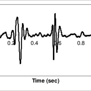 Example Phonocardiogram | Download Scientific Diagram