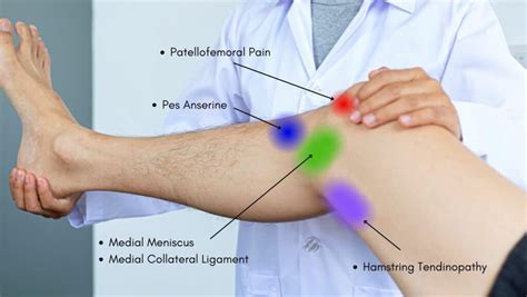 Knee Pain Location Chart | Learn the Pain Location of Knee Injuries