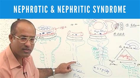 Nephrotic & Nephritic Syndrome - Causes, Symptoms & Treatment - YouTube