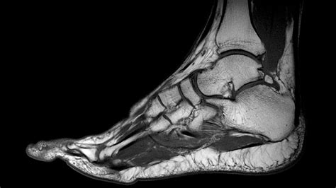 Foot Muscles Mri : The Radiology Assistant : Ankle - MRI examination ...