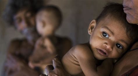 Is Malnutrition Stunting Young India's Growth, Literally? | SabrangIndia