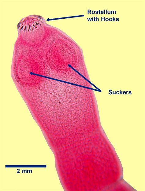 Echinococcus multilocularis - Learn About Parasites - Western College ...