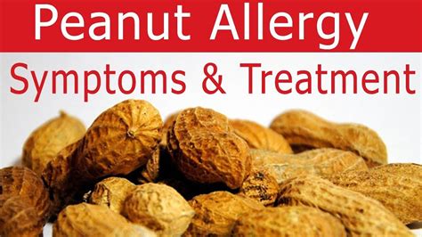 Peanut Allergy - Causes, Reaction, Signs, Symptoms & Treatment