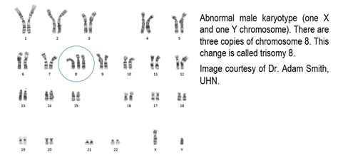 Karyotype | Pathology dictionary | MyPathologyReport.ca