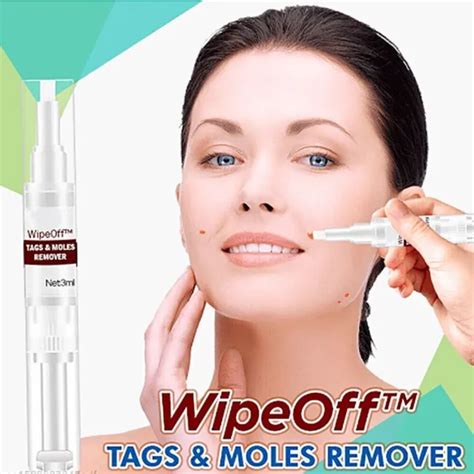 COMMON AND PLANTAR Moles-Off Wartsoff Remover WipeOff Tags & Moles ...