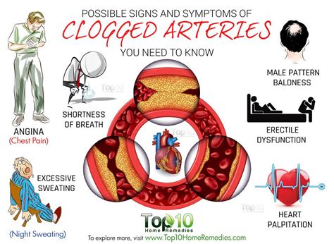 10 Possible Signs and Symptoms of Clogged Arteries You Need to Know ...