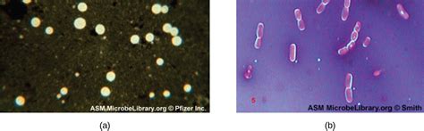 Staining Microscopic Specimens | Microbiology