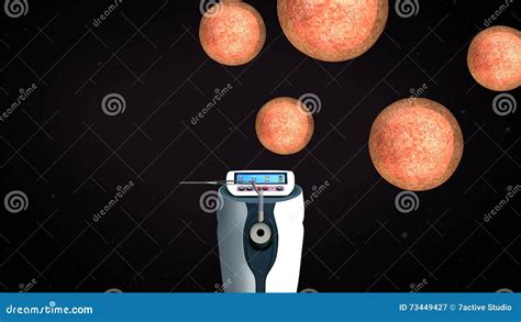 IVF Embryo storage stock illustration. Illustration of pregnancy - 73449427