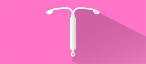 IUD Removal: What to Expect - BuzzRx