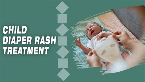 Child Diaper Rash Treatment [5 Best Ways]