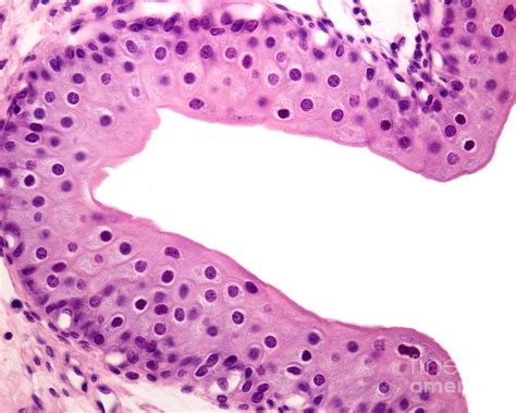 Ureter Transitional Epithelium by Science Photo Library