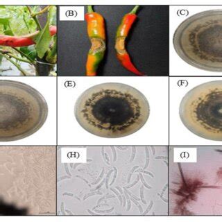 Antracnose symptoms on chilli pod during sampling (A) and (B), top ...