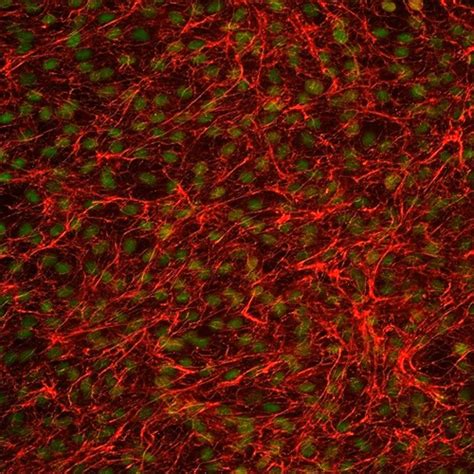 Human Annulus Fibrosus Cells - Innoprot Skeletal Cell System