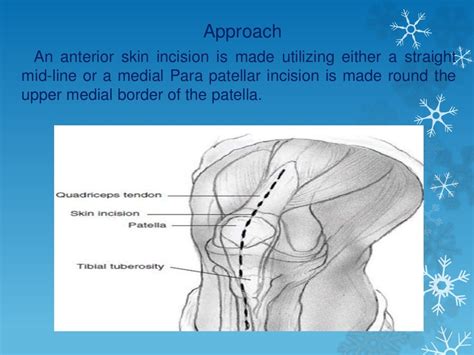 arthroscopic versus open synovectomy in rheumatoid knee