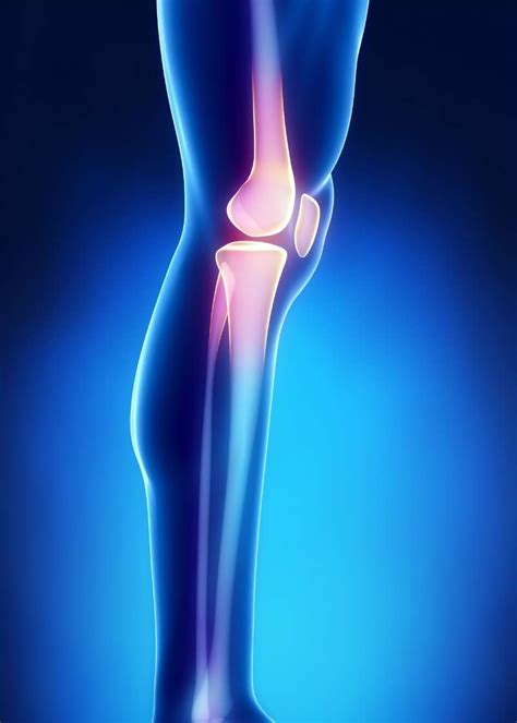 What is Patellofemoral Pain Syndrome? | Moyer Total Wellness