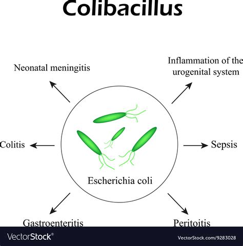 E coli diseases causing coli infographics Vector Image