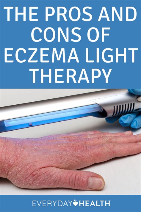 The Pros and Cons of Eczema Light Therapy | Everyday Health in 2021 ...