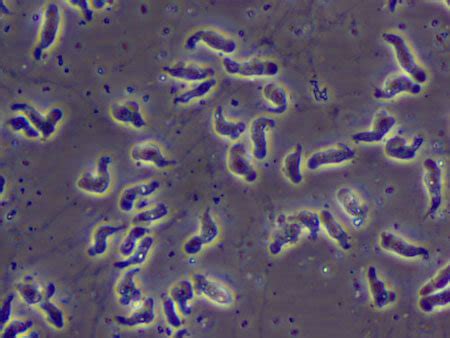 Fish Tank Granuloma and Other Waterborne Diseases