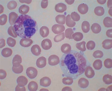 VETERINARY HEMATOLOGY DEXTERVET: Partially degranulated eosinophils