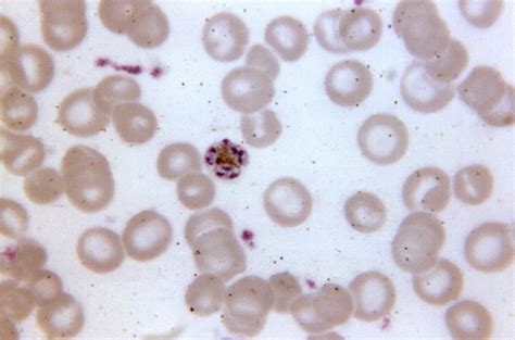 Plasmodium Malariae Morphology