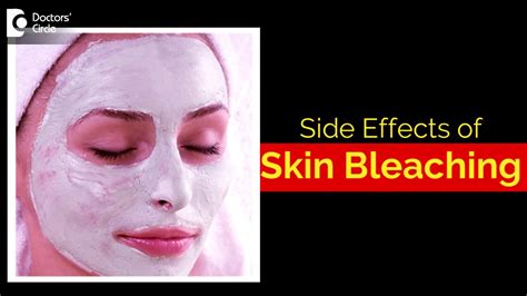 What are the side effects of bleaching your skin? - Dr. Aruna Prasad - YouTube