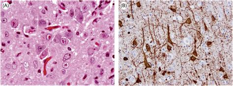 Paramyxoviridae and Pneumoviridae | Veterian Key