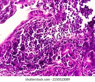 Ileum Histology Photos and Images & Pictures | Shutterstock