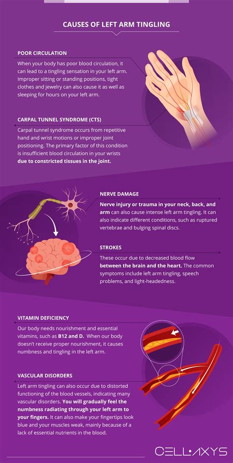 Tingling in Left Arm: Causes and When to Call Your Doctor - kienitvc.ac.ke