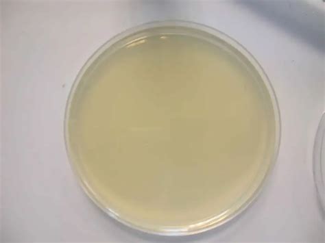 Nutrient agar - Composition, Preparation and Uses