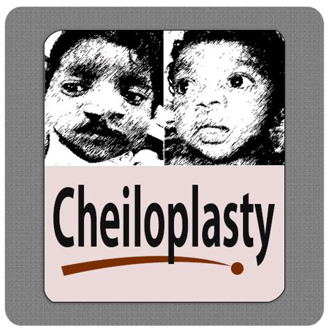 Cheiloplasty - Richardson dental and craniofacial Hospitalposts