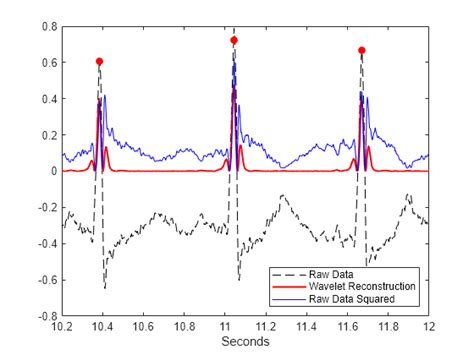 R Wave Detection in the ECG