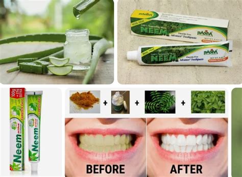 Neem Toothpaste Benefits - Benefits Of Neem Toothpaste