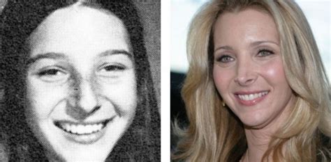 Lisa Kudrow Before Nose Job Before And After Photos