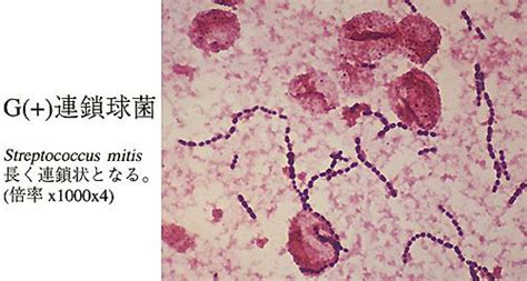 Streptococcus mitis | Bacteria, Radish, Vegetables