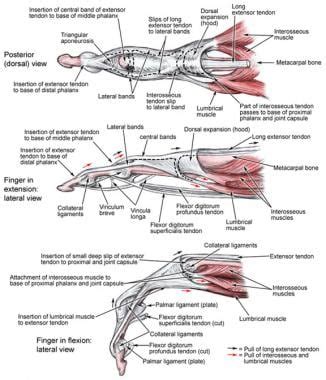 Metacarpophalangeal Joint Ligaments