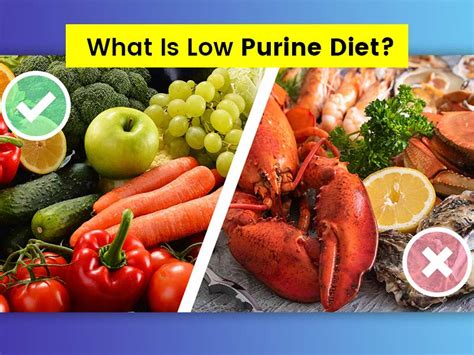 What is Low-Purine Diet? Know Which Foods To Add and Avoid | OnlyMyHealth