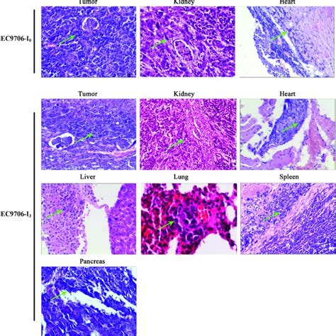 Tumor cells metastasis in the EC9706 xenograft subrenal capsule model... | Download Scientific ...