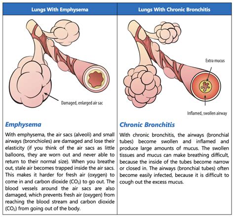 Living well with COPD: Chronic Bronchitis and Emphysema