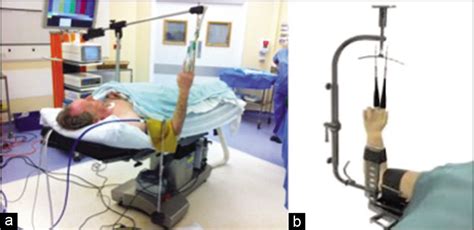 Recent advances and future trends in wrist arthroscopy - Journal of Arthroscopic Surgery and ...