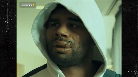 UFC's Alistair Overeem Shows Stitched Up Face After Violent TKO