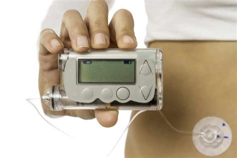 What are the Pros and Cons of Insulin Pumps? Is It Right for You?