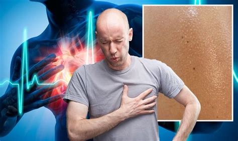 Heart attack symptoms: Signs include clammy skin | Express.co.uk