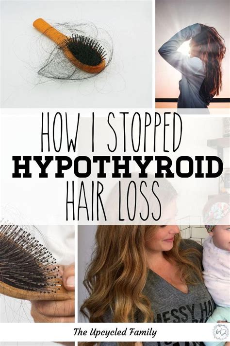 What Helps Hair Loss From Thyroid Tips And Hair Care In 2023 - Semi ...