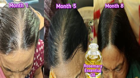 Benefits Of Rosemary Oil For Hair Growth - Vinaywa