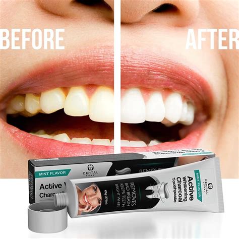 Activated Charcoal Teeth Whitening Toothpaste Review